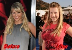 Full-House-Jodie-Sweetin-plastic-surgery-before-and-after-breast-augmentation
